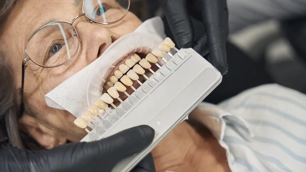 descubra os beneficios transformadores das facetas no seu bem estar