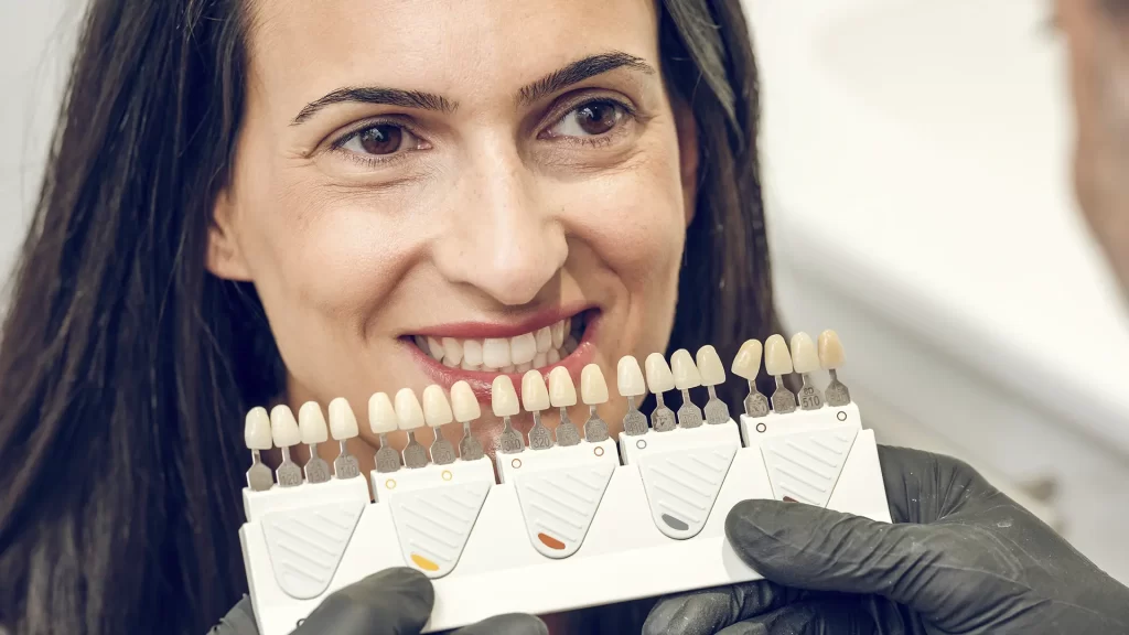 Ilustração de dentes com manchas, lascas, diastema e desalinhamento corrigidos por facetas dentárias