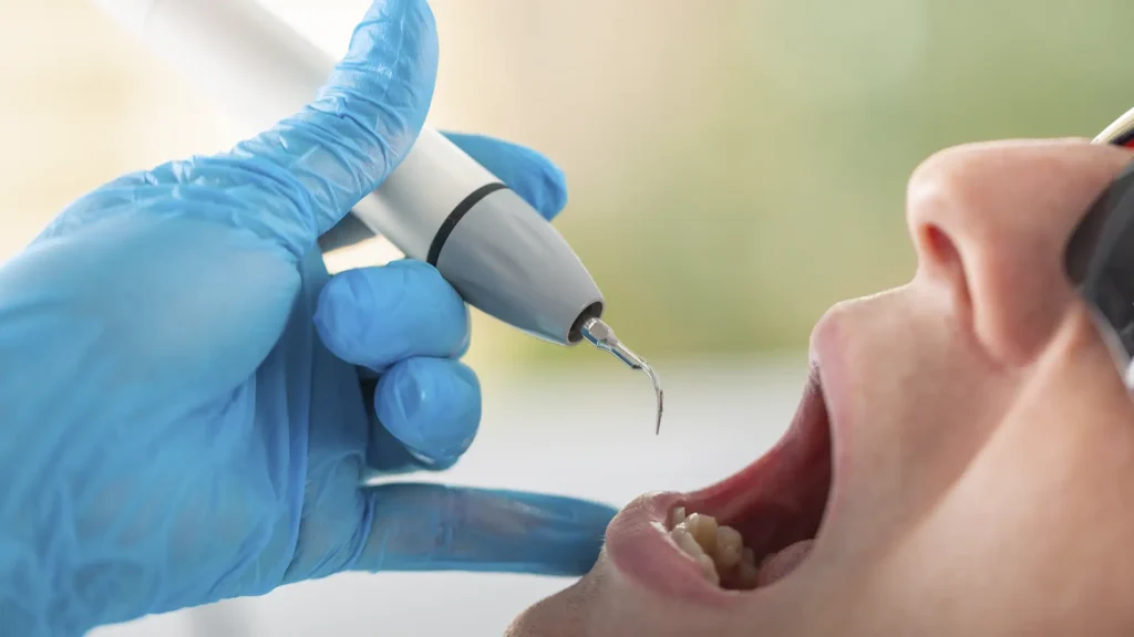 Dentista realizando tratamento de canal com instrumentos de alta tecnologia, representando os cuidados essenciais para a saúde bucal oferecidos pela Mund Concept em Botucatu e região.