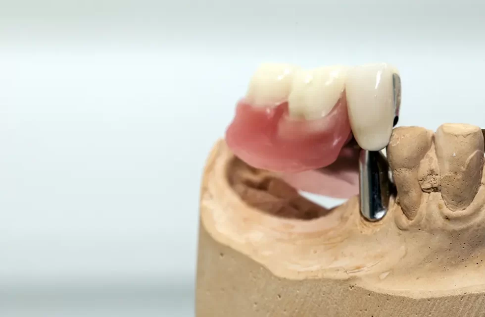 descubra a melhor prótese dentária em Botucatu e Região